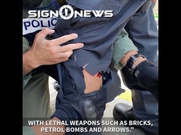 ICYMI: Police shot with arrow