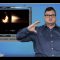 Sign1News 8.2.19 – News for the Deaf community powered by CNN in American Sign Language (ASL).