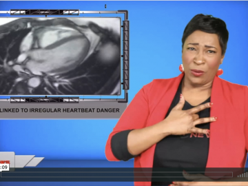 Burnout linked to irregular heartbeat danger