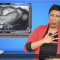 Burnout linked to irregular heartbeat danger