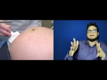 What to know if you’re pregnant during pandemic