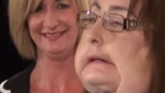 ICYMI: 1st US face transplant recipient Connie Culp dies (8.2.20)